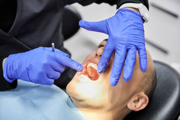 Best Broken or Cracked Tooth Emergency Dentist in Footville, WI